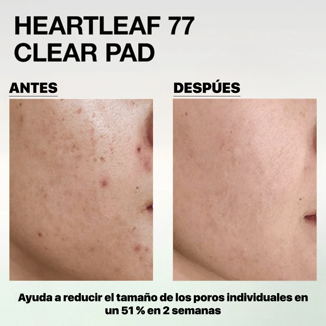 Anua toner pads antes y despues